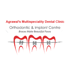Dr. Chintan Agrawal | Braces Doctor in Ahmedabad